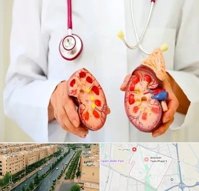 دکتر سنگ کلیه در فاز سه اندیشه