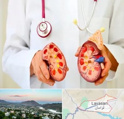 دکتر سنگ کلیه در لواسان