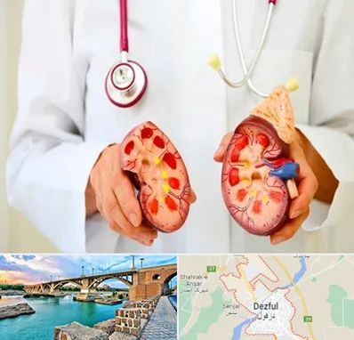 دکتر سنگ کلیه در دزفول
