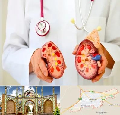 دکتر سنگ کلیه در سمنان