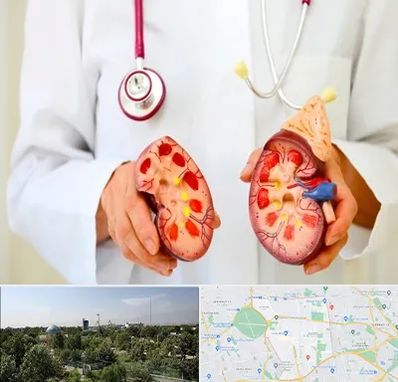 دکتر سنگ کلیه در منطقه 16 تهران 