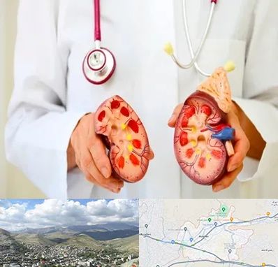 دکتر سنگ کلیه در رودهن