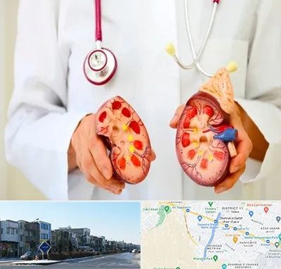 دکتر سنگ کلیه در شریعتی مشهد 