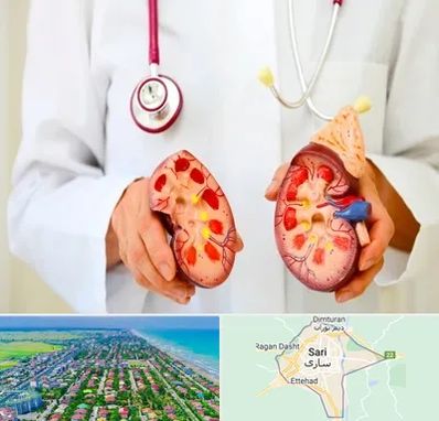 دکتر سنگ کلیه در ساری