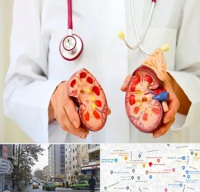 دکتر سنگ کلیه در فاطمی 