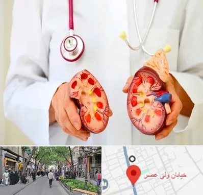 دکتر سنگ کلیه در ولیعصر شهریار