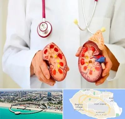 دکتر سنگ کلیه در کیش
