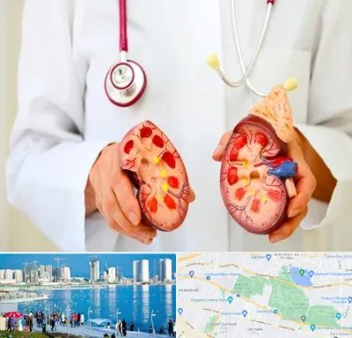 دکتر سنگ کلیه در چیتگر 