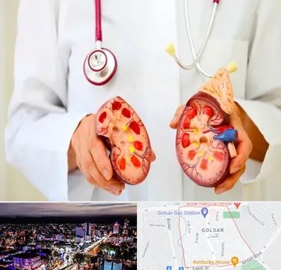 دکتر سنگ کلیه در گلسار رشت 