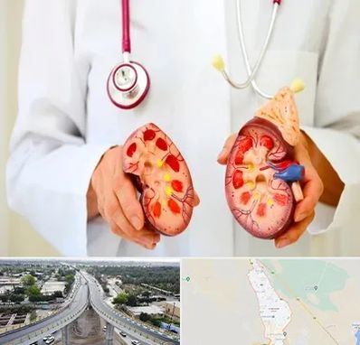 دکتر سنگ کلیه در اندیمشک