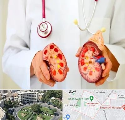 دکتر سنگ کلیه در جهانشهر کرج 