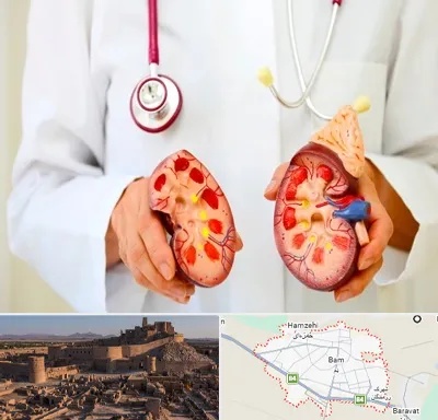 دکتر سنگ کلیه در بم