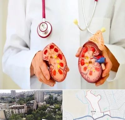 دکتر سنگ کلیه در اوین