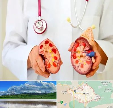 دکتر سنگ کلیه در مرند