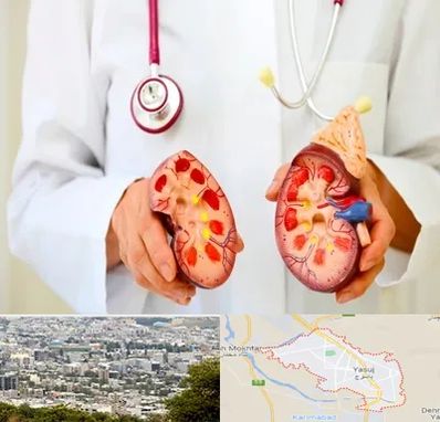 دکتر سنگ کلیه در یاسوج