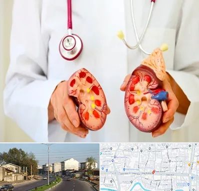 دکتر سنگ کلیه در ضیابری رشت 