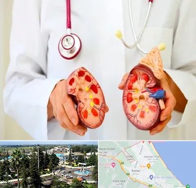 دکتر سنگ کلیه در رودسر