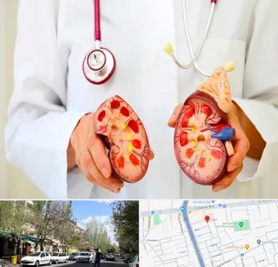 دکتر سنگ کلیه در کوی فیروز تبریز