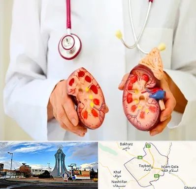 دکتر سنگ کلیه در تایباد