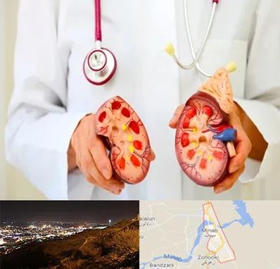 دکتر سنگ کلیه در میناب