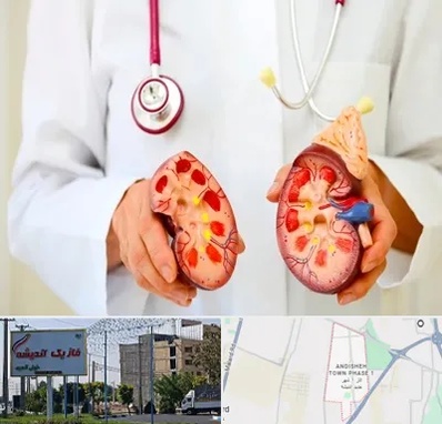 دکتر سنگ کلیه در فاز یک اندیشه