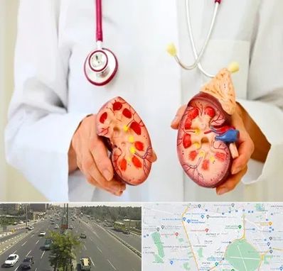 دکتر سنگ کلیه در منطقه 17 تهران 