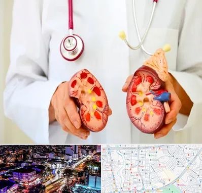 دکتر سنگ کلیه در منظریه رشت 