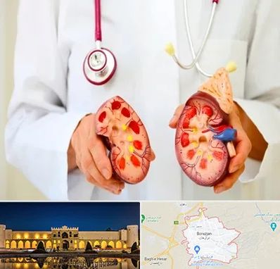 دکتر سنگ کلیه در برازجان