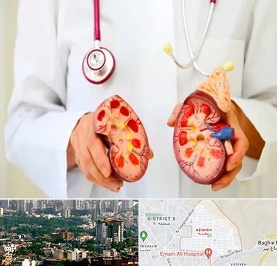 دکتر سنگ کلیه در عظیمیه کرج 