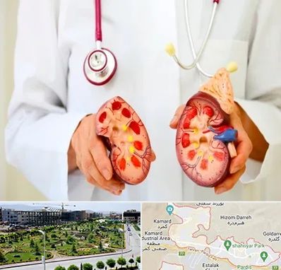 دکتر سنگ کلیه در پردیس