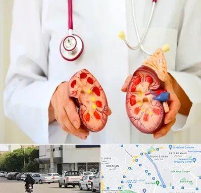 دکتر سنگ کلیه در قدوسی شرقی شیراز 