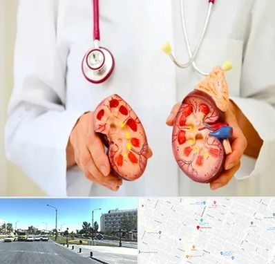 دکتر سنگ کلیه در بلوار کلاهدوز مشهد 