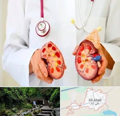 دکتر سنگ کلیه در علی آباد کتول
