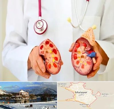 دکتر سنگ کلیه در ملایر