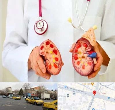 دکتر سنگ کلیه در شهناز تبریز
