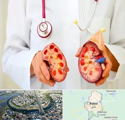 دکتر سنگ کلیه در بابل