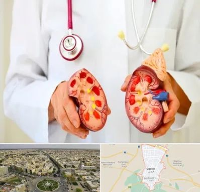 دکتر سنگ کلیه در قزوین