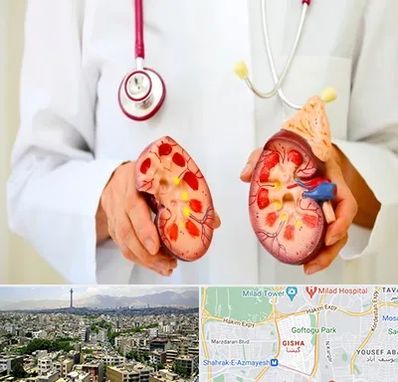 دکتر سنگ کلیه در گیشا 
