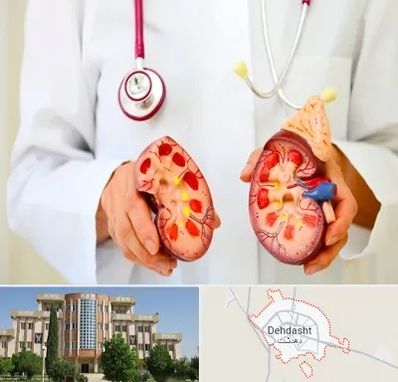 دکتر سنگ کلیه در دهدشت