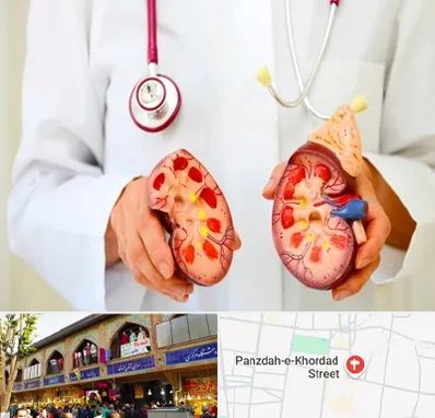 دکتر سنگ کلیه در 15 خرداد