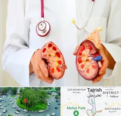 دکتر سنگ کلیه در تجریش 