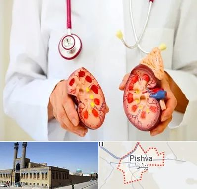 دکتر سنگ کلیه در پیشوا