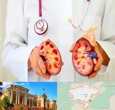 دکتر سنگ کلیه در خوی