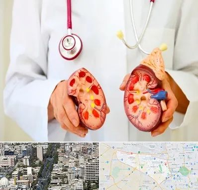 دکتر سنگ کلیه در منطقه 18 تهران 