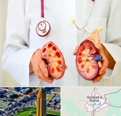 دکتر سنگ کلیه در گنبد کاووس