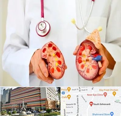 دکتر سنگ کلیه در سهروردی 