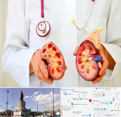 دکتر سنگ کلیه در کارگر جنوبی 