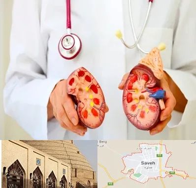 دکتر سنگ کلیه در ساوه