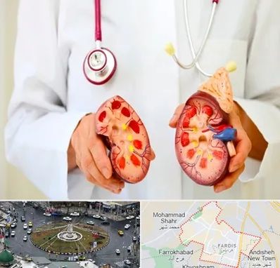 دکتر سنگ کلیه در فردیس کرج 