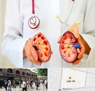 دکتر سنگ کلیه در بازار تهران